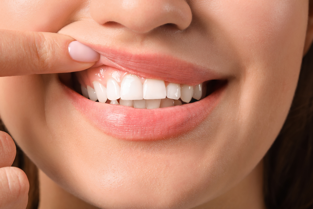 the Color of Your Gums Say About Your Dental Health