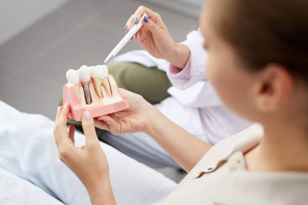 dental implant recovery timeline what to expect